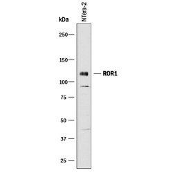 Human ROR1 Antibody, R D Systems 100&mu;g; Unlabeled:Antibodies, Polyclonal