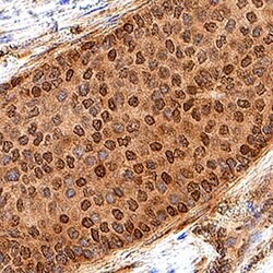 Human Rad51 Antibody, R D Systems 100 &mu;g Unconjugated:Antibodies, Monoclonal