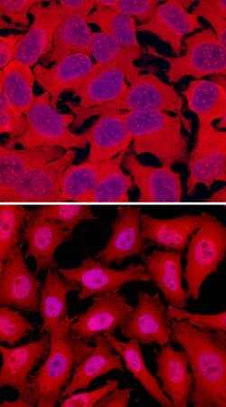 Human/Mouse/Rat RelA/NF kappa B p65 Antibody, R D Systems 25&mu;g; Unlabeled:Antibodies,