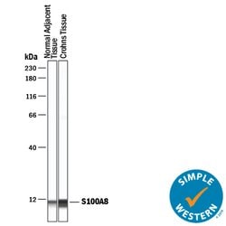Human S100A8 Antibody, R D Systems 100&mu;g; Unlabeled:Antibodies, Polyclonal