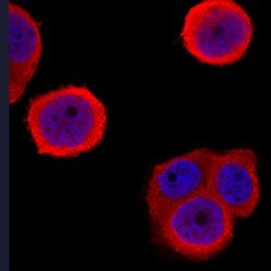 Human S100A9 Antibody, R D Systems 25&mu;g; Unlabeled:Antibodies, Polyclonal
