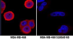 Human S100A9 Antibody, R D Systems 25&mu;g; Unlabeled:Antibodies, Polyclonal