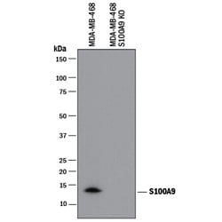Human S100A9 Antibody, R D Systems 25&mu;g; Unlabeled:Antibodies, Polyclonal