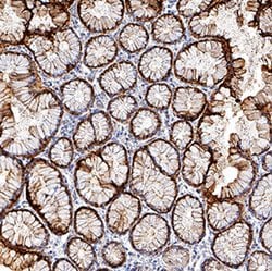 Human S100P Antibody, R D Systems 25 &mu;g; Unconjugated:Antibodies, Monoclonal