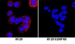Human S100P Antibody, R D Systems 25&mu;g; Unlabeled:Antibodies, Polyclonal
