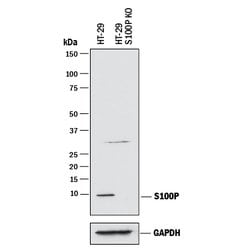 Human S100P Antibody, R D Systems 25&mu;g; Unlabeled:Antibodies, Monoclonal