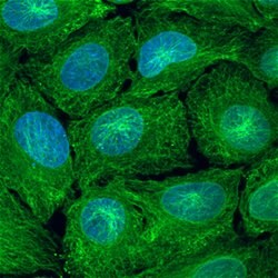 Human/Mouse SOCS-3 Antibody, R D Systems 100ug; Unlabeled:Antibodies, Monoclonal