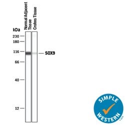 Human SOX9 Antibody, R D Systems 25&mu;g; Unlabeled:Antibodies, Polyclonal