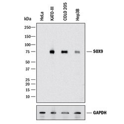 Human SOX9 Antibody, R D Systems 25&mu;g; Unlabeled:Antibodies, Polyclonal