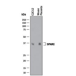 Mouse SPARC Antibody, R D Systems 500ug; Unlabeled:Antibodies, Monoclonal