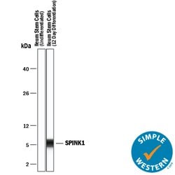 Human SPINK1 Antibody, R D Systems 25&mu;g; Unlabeled:Antibodies, Polyclonal