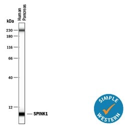 Human SPINK1 Antibody, R D Systems 100ug; Unlabeled:Antibodies, Monoclonal