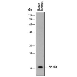 Human SPINK1 Antibody, R D Systems 100ug; Unlabeled:Antibodies, Monoclonal