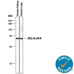 Human ST2/IL-33R Antibody, R D Systems 100&mu;g; Unlabeled:Antibodies,