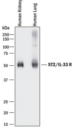 Human ST2/IL-33R Antibody, R D Systems 100&mu;g; Unlabeled:Antibodies,