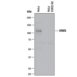 Human STAT2 Antibody, R D Systems 100&mu;g; Unlabeled:Antibodies, Monoclonal