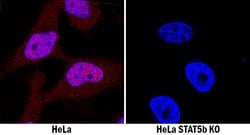 Human/Mouse/Rat STAT5b Antibody, R D Systems 100 ug; Unconjugated:Antibodies,