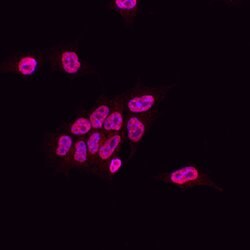 SUZ12 Mouse anti-Human, Clone: 448909, R D Systems 25&mu;g; Unlabeled,