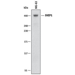 Human SVEP1 Antibody, R D Systems:Antibodies:Primary Antibodies