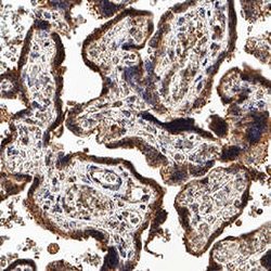 Human SVEP1 Antibody, R D Systems:Antibodies:Primary Antibodies