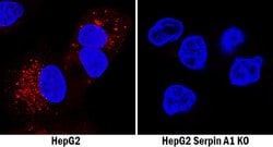 Human Serpin A1/alpha 1-Antitrypsin Antibody, R D Systems 25&mu;g; Unlabeled:Antibodies,