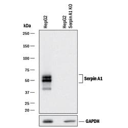 Human Serpin A1/alpha 1-Antitrypsin Antibody, R D Systems 25&mu;g; Unlabeled:Antibodies,
