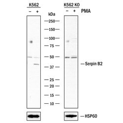 Human Serpin B2 Antibody, R D Systems 100&mu;L:Antibodies, Polyclonal