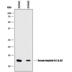 Human Serum Amyloid A1/A2 Antibody, R D Systems:Antibodies:Primary Antibodies