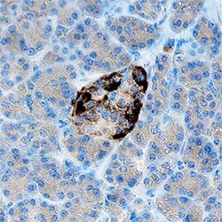 Human/Mouse Somatostatin Antibody, R D Systems:Antibodies:Primary Antibodies