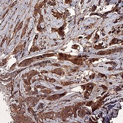 Human Survivin Antibody, R D Systems 25&mu;g; Unlabeled:Antibodies, Polyclonal
