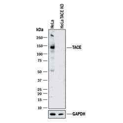Human TACE/ADAM17 Cytosolic Domain Antibody, R D Systems 100&mu;g; Unlabeled:Antibodies,