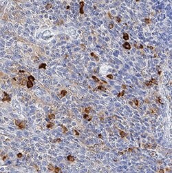 Human TAP2 Antibody, R D Systems:Antibodies:Primary Antibodies
