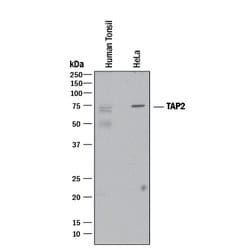 Human TAP2 Antibody, R D Systems:Antibodies:Primary Antibodies