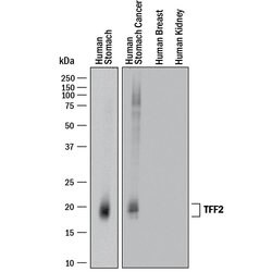 Human TFF2 Antibody, R D Systems:Antibodies:Primary Antibodies