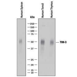 Human TIM-3 Antibody, R D Systems:Antibodies:Primary Antibodies