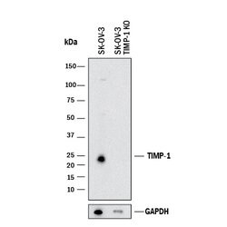 Human TIMP-1 Antibody, R D Systems 100&mu;g; Unlabeled:Antibodies, Polyclonal