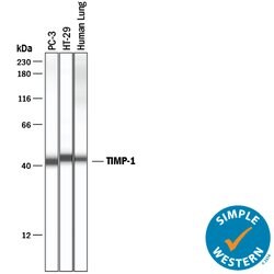 Human TIMP-1 Antibody, R D Systems 100&mu;g; Unlabeled:Antibodies, Polyclonal