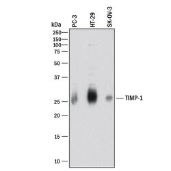 Human TIMP-1 Antibody, R D Systems 100&mu;g; Unlabeled:Antibodies, Polyclonal