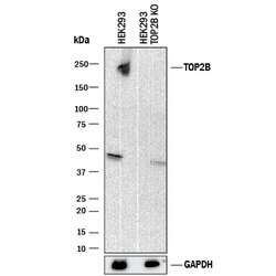 Human TOP2B Antibody, R D Systems 100&mu;g; Unlabeled:Antibodies, Polyclonal