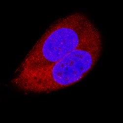 Human TRADD Antibody, R D Systems 25 &mu;g | Buy Online | R&D Systems | Fisher Scientific