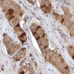 Human Thymidine Kinase 1 Antibody, R D Systems 25 &mu;g; Unconjugated:Antibodies,