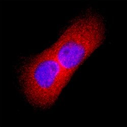 Human Thymidine Kinase 1 Antibody, R D Systems 25 &mu;g; Unconjugated:Antibodies,
