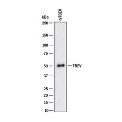 Viral Tick-borne Encephalitis Virus NS1 Antibody, R D Systems:Antibodies:Primary