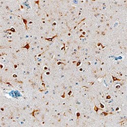 Human/Mouse Tmp21/p23 Antibody, R D Systems 25&mu;g; Unlabeled:Antibodies,