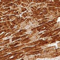 Human Troponin T (Cardiac) Antibody, R D Systems 100 &mu;g Unconjugated:Antibodies,