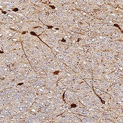 Human Tryptophan Hydroxylase 1/TPH-1 Antibody, R D Systems 100&mu;g; Unlabeled:Antibodies,