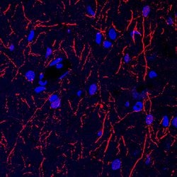Human Tryptophan Hydroxylase 1/TPH-1 Antibody, R D Systems 100&mu;g; Unlabeled:Antibodies,