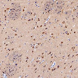 Human/Mouse/Rat UCH-L1/PGP9.5 Antibody, R D Systems 25ug; Unlabeled:Antibodies,