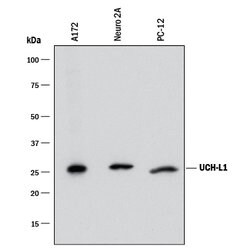 Human/Mouse/Rat UCH-L1/PGP9.5 Antibody, R D Systems 25ug; Unlabeled:Antibodies,