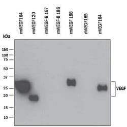 Mouse VEGF164 Antibody, R D Systems 25&mu;g; Unlabeled:Antibodies, Polyclonal